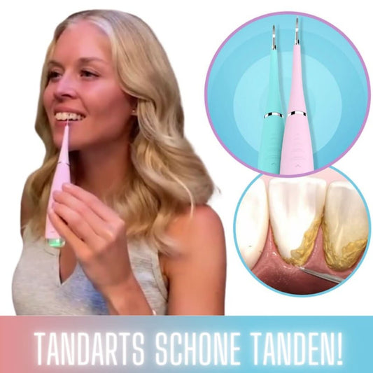 Elektrische Tandreiniger – Verwijder Zelf Tandsteen & Tandplak